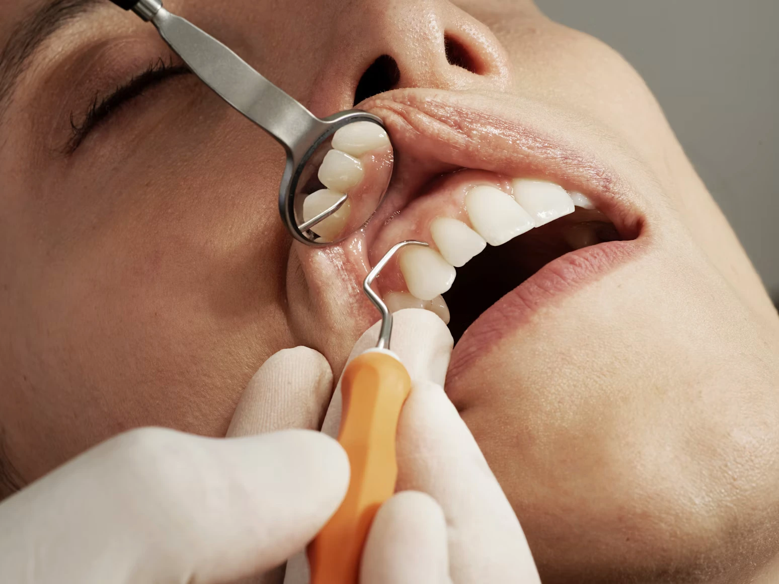 Alitosi cause e rimedi - Studio Dr. Luigi di Bari Manfredonia