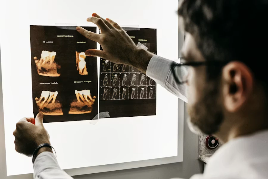 Ascesso dentale dente gonfio - Studio Dr. Luigi di Bari Manfredonia